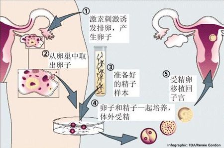 私人高龄借卵联系电话
